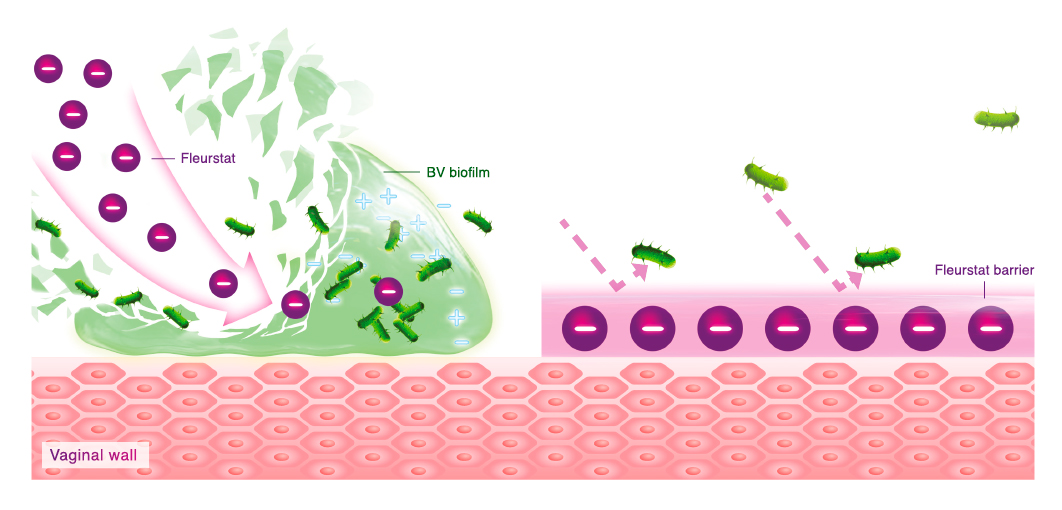 Bacterial Vaginosis cause